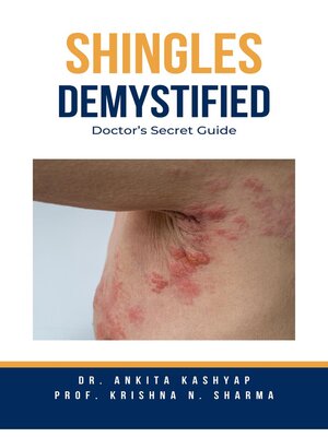 cover image of Shingles Demystified